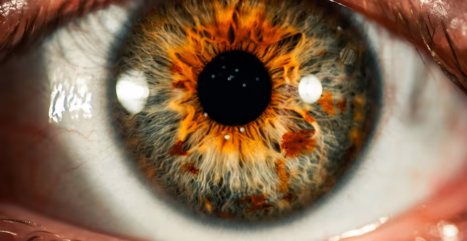 Teleophthalmology with optical coherence tomography imaging in community optometry. Evaluation of a quality improvement for macular patients
