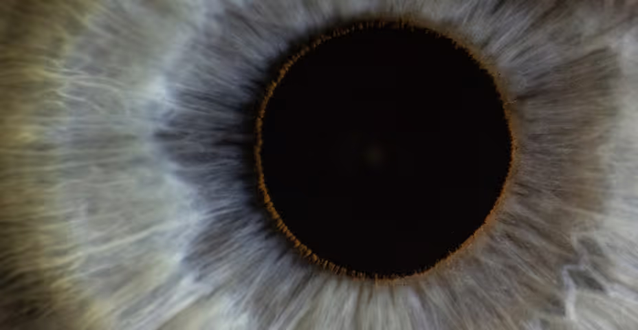 Refractive outcome analyses in myopes