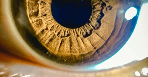 Phlyctenulosis: a systemic diagnosis made or missed in the blink of an eye